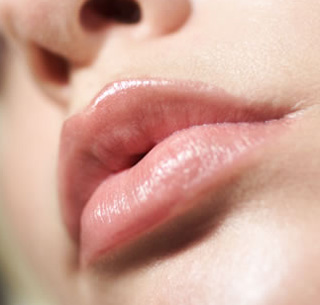 Increasing volume of the lips without wrinkles with fillers